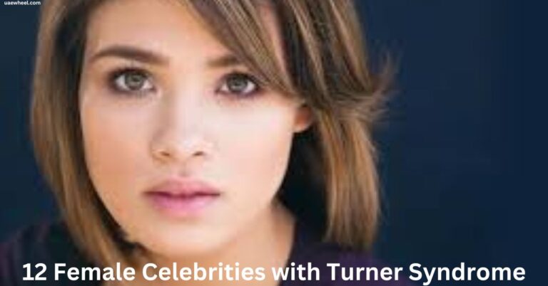 12 Famous People and Celebrities with Turner Syndrome